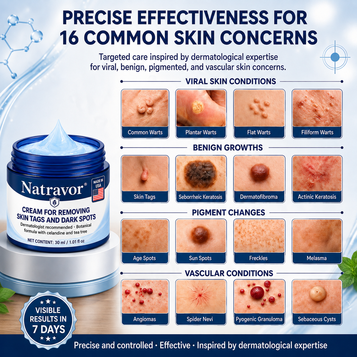 Natravor® 7-𝐃𝐚𝐲 𝐒𝐤𝐢𝐧 𝐓𝐚𝐠 & 𝐒𝐩𝐨𝐭 𝐄𝐫𝐚𝐬𝐞𝐫 𝐂𝐫𝐞𝐚𝐦 , Moles & Spots – 7‑Day Painless & Scar‑Free – Advanced Care for Skin Imperfections 💎