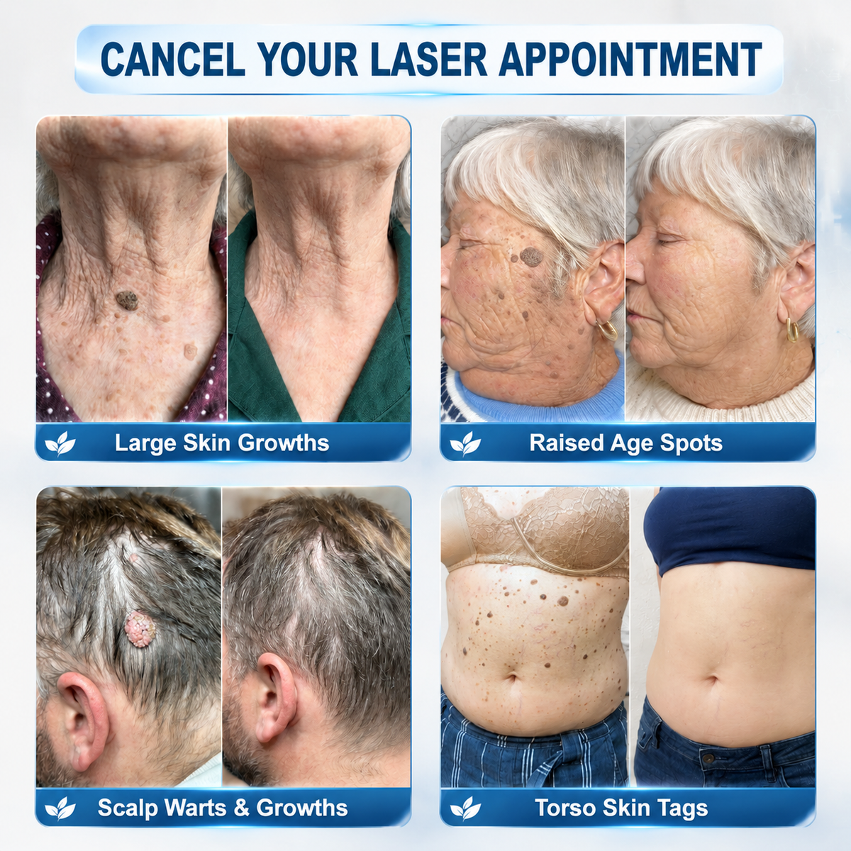 Natravor® 7-𝐃𝐚𝐲 𝐒𝐤𝐢𝐧 𝐓𝐚𝐠 & 𝐒𝐩𝐨𝐭 𝐄𝐫𝐚𝐬𝐞𝐫 𝐂𝐫𝐞𝐚𝐦 , Moles & Spots – 7‑Day Painless & Scar‑Free – Advanced Care for Skin Imperfections 💎
